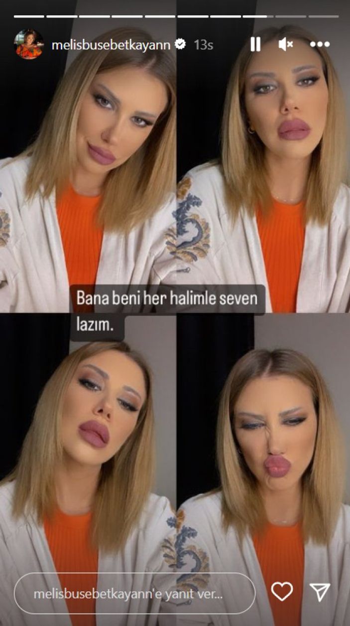 Kısmetse Olur'un Melis'i tanınmaz halde! Fenomen ismi son estetiklerden sonra gören tanıyamıyor