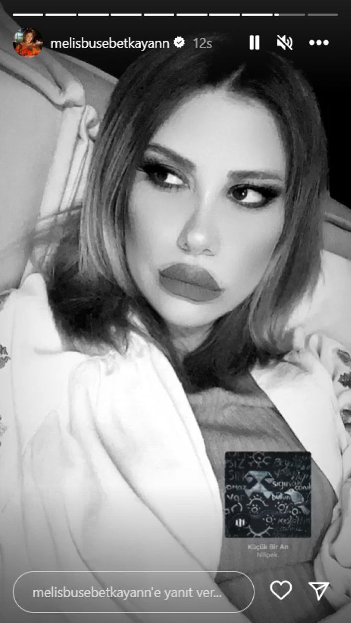 Kısmetse Olur'un Melis'i tanınmaz halde! Fenomen ismi son estetiklerden sonra gören tanıyamıyor