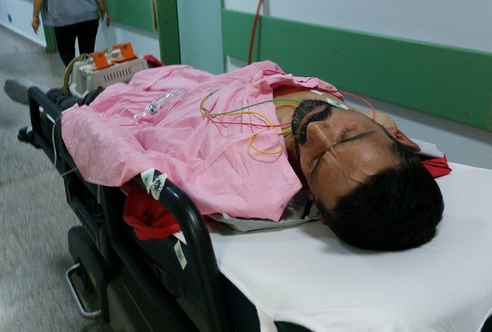 Samsun'da yemek yerken kardeşinin bıçaklı saldırısına uğradı