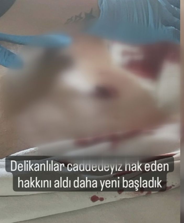 Ankara'da lise öğrencisi arkadaşlarına bıçakla saldırdı