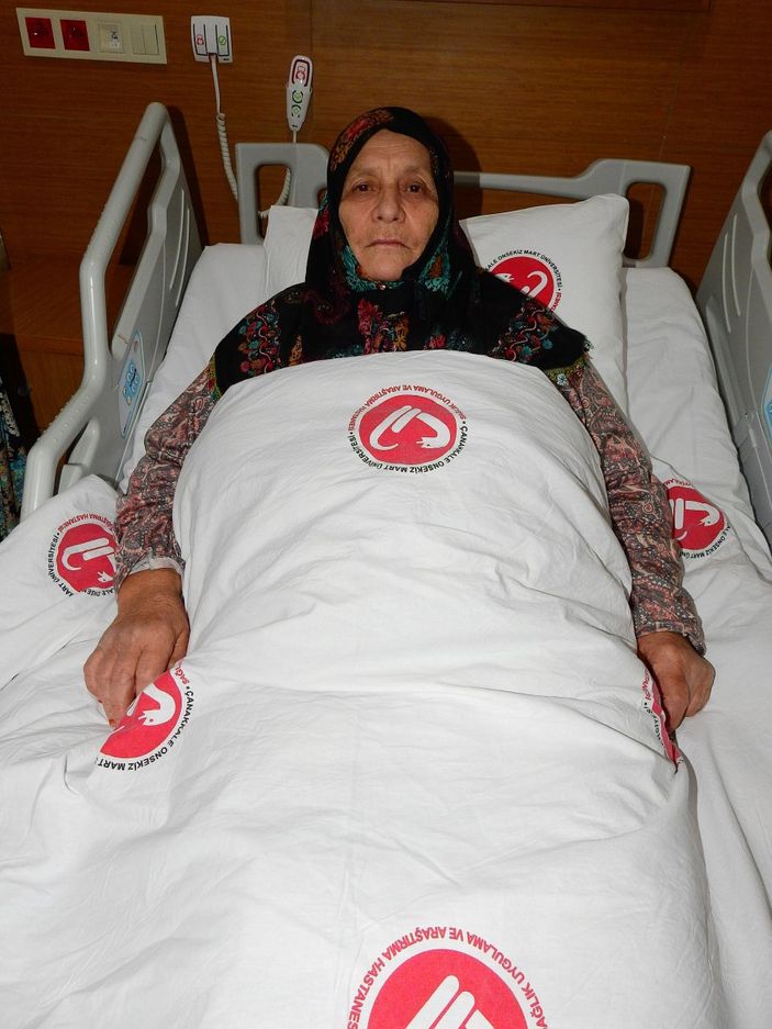 Çanakkale’de kadının böbreğindeki taş, 100 parçaya ayrılarak çıkarıldı