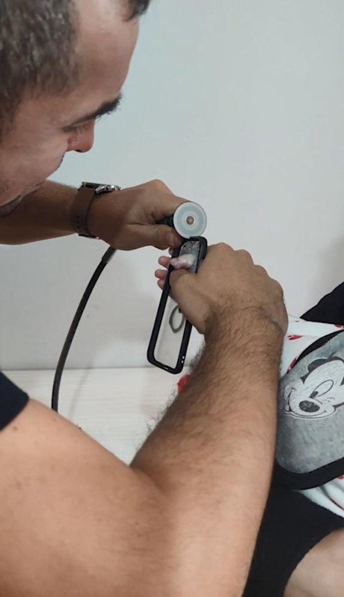 Kocaeli’de, bebeğin parmağı telefon kılıfındaki deliğe sıkıştı