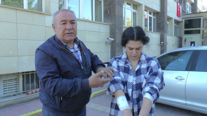 Nevşehir'de genç kıza 15 köpek saldırdı