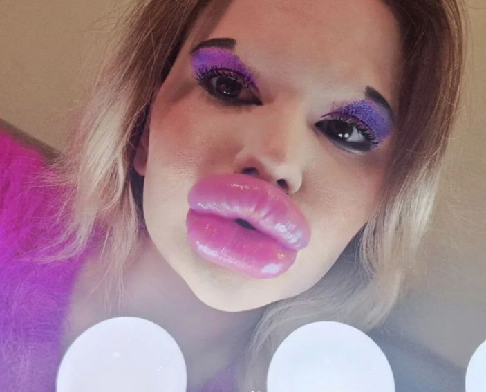 Bulgaristanlı genç kadın estetik rekoru kırıyor