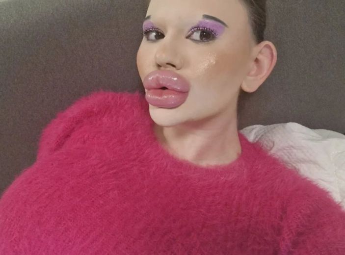 Bulgaristanlı genç kadın estetik rekoru kırıyor