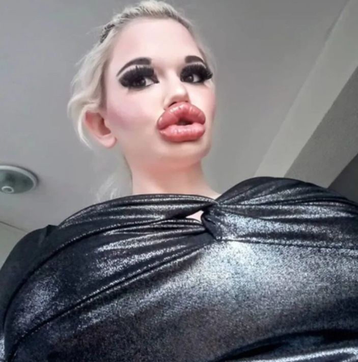 Bulgaristanlı genç kadın estetik rekoru kırıyor