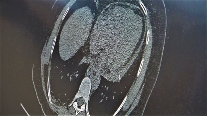 i Profesör açıkladı: Maskeye dönmenin zamanı geldi