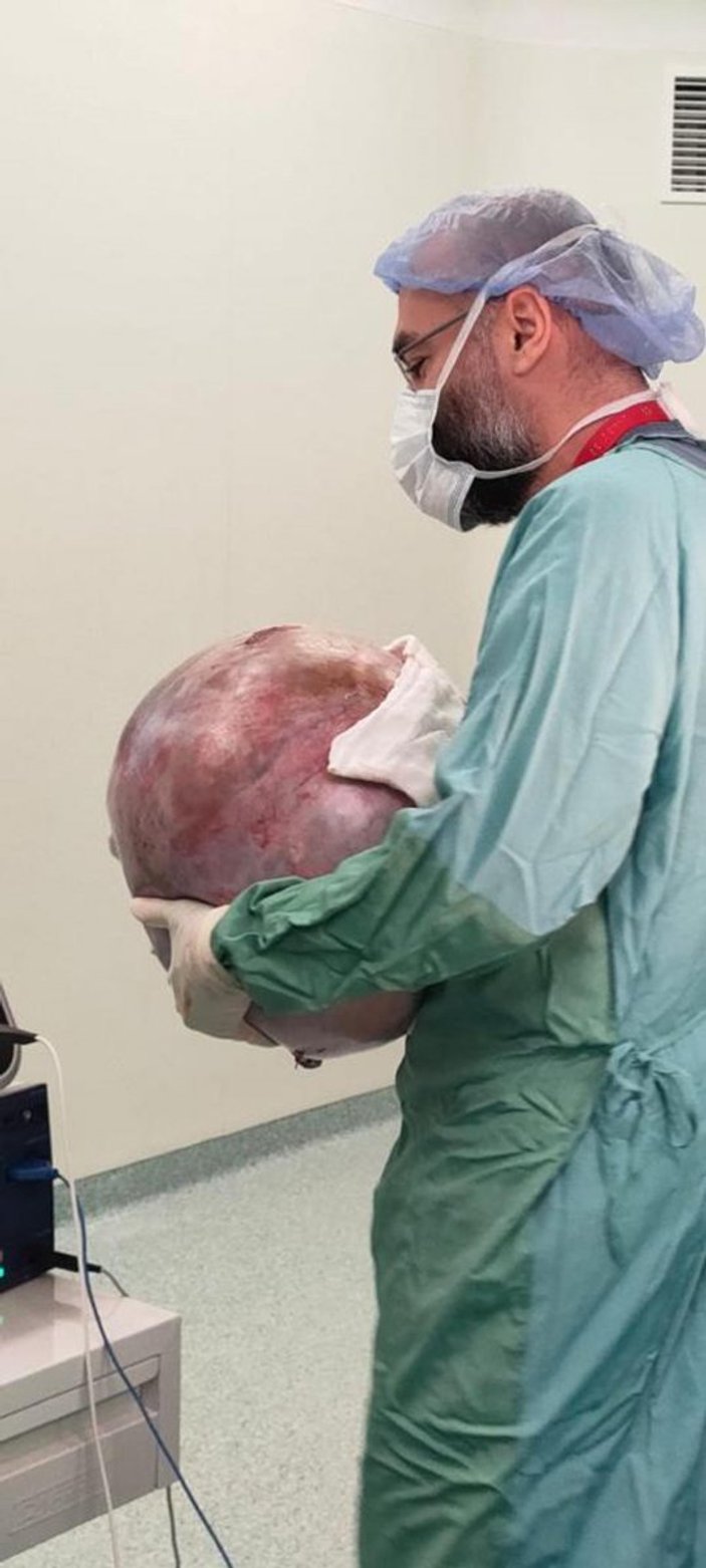Tekirdağ’da, hastanın karnından 35 kilogram kitle çıkarıldı