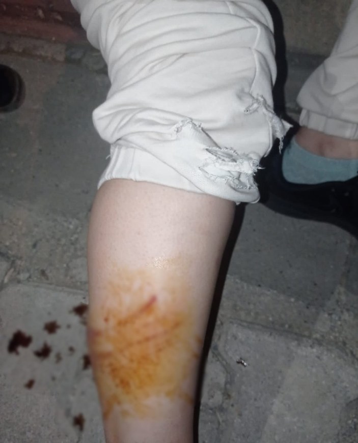 Mersin'de hamile kadın köpek saldırısına uğradı