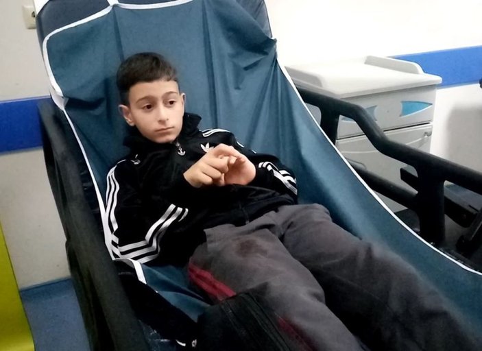 Tekirdağ’da pitbull, 10 yaşındaki çocuğu bacağından ısırdı