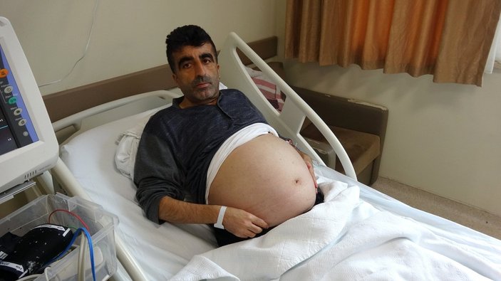 Tokat'ta, hastanın karnından 13 kilogram kitle çıktı