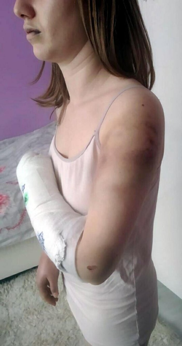 İzmir’de sevgilisini beyzbol sopasıyla döven sanığa 10 ay hapis