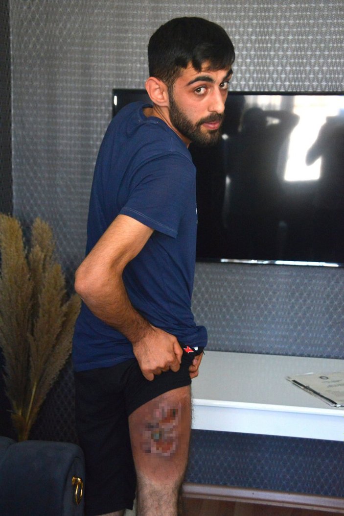 Adana'da şaka kurbanı Abdullah, 12 yıldır geçmeyen yarasına çare arıyor