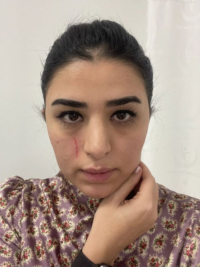 Mersin'de kadın doktoru darbeden iki sanık serbest kaldı