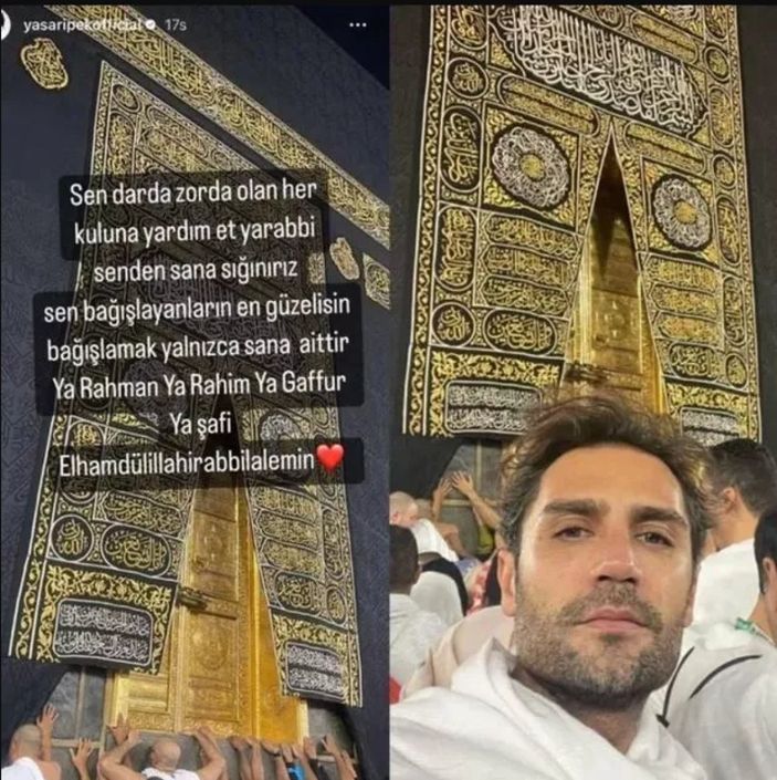 Yaşar İpek, çenesini yaptırdı