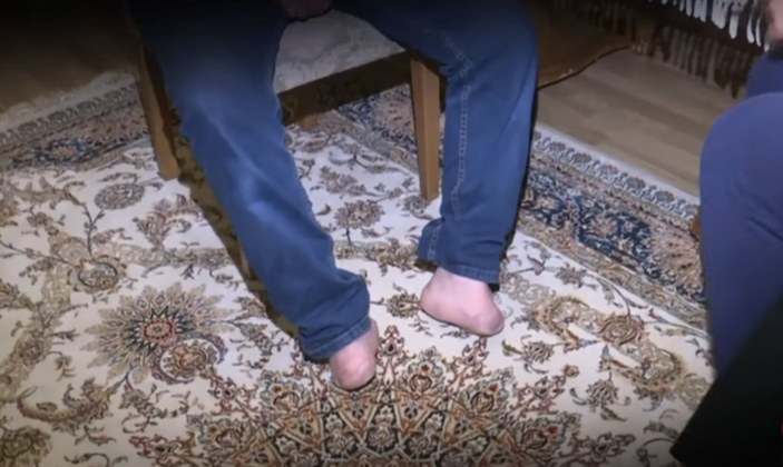 Hocalı'dan kaçarken ayaklarını kaybeden Salman Kasımov