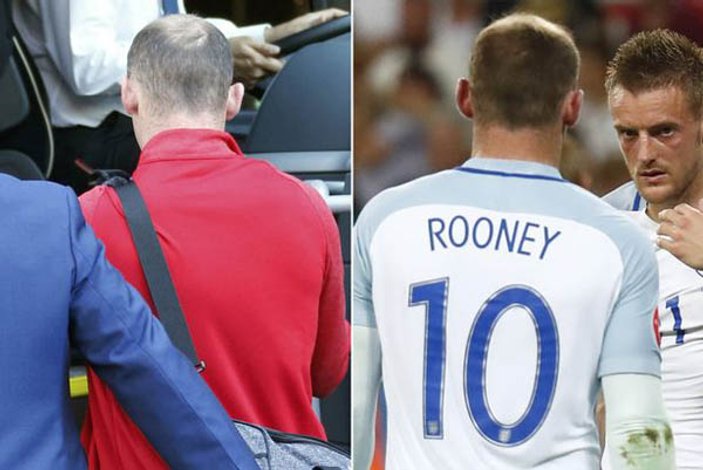 İngilizler Rooney bir gecede kel kaldı diyor