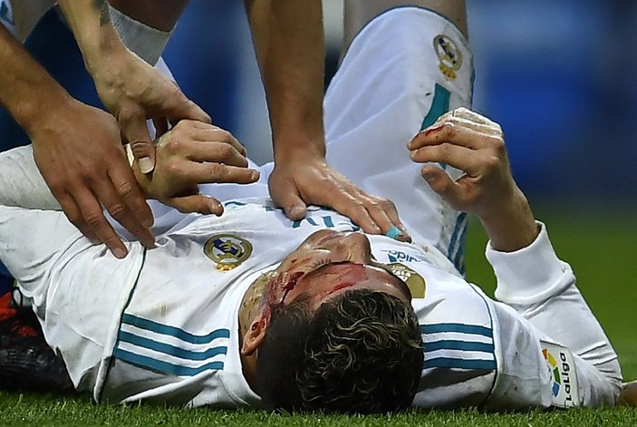 Ronaldo kanlar içinde kaldı