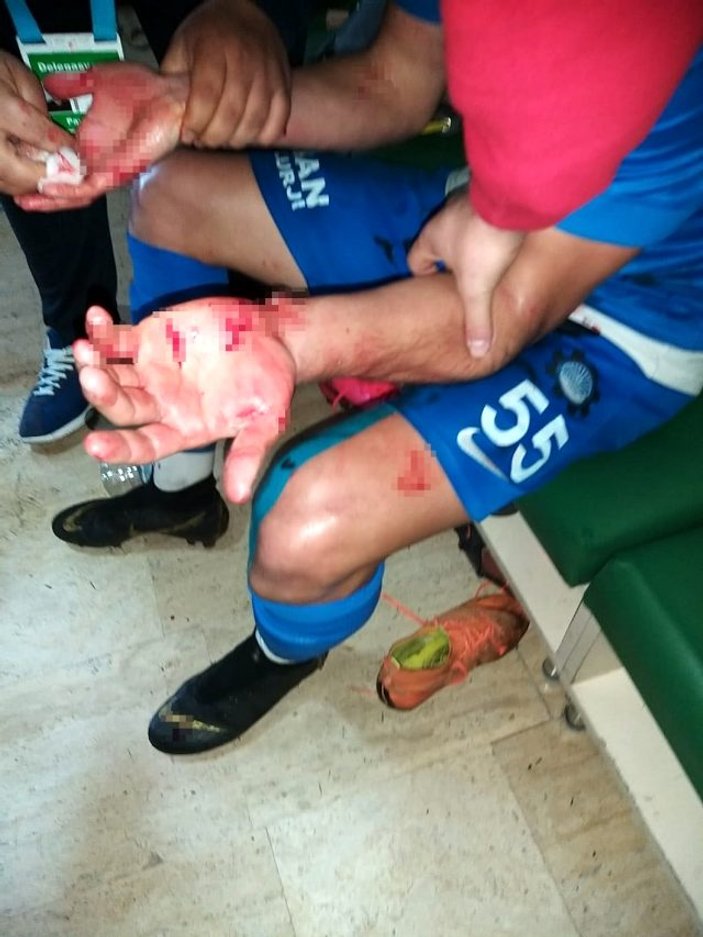Maç sonrası futbolculara bıçaklı saldırı