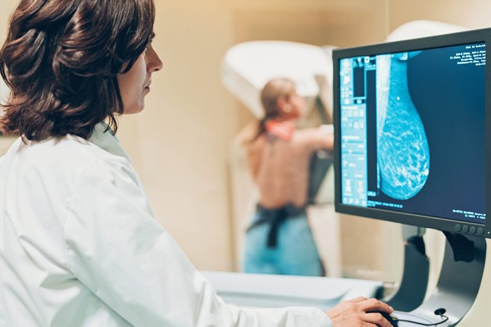 Mamografi meme kanserini 4 yıl önceden tespit edebilir
