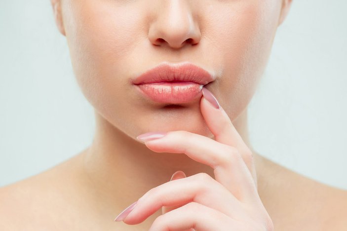 Üst dudak ve burun arası ameliyatsız düzeltilebiliyor