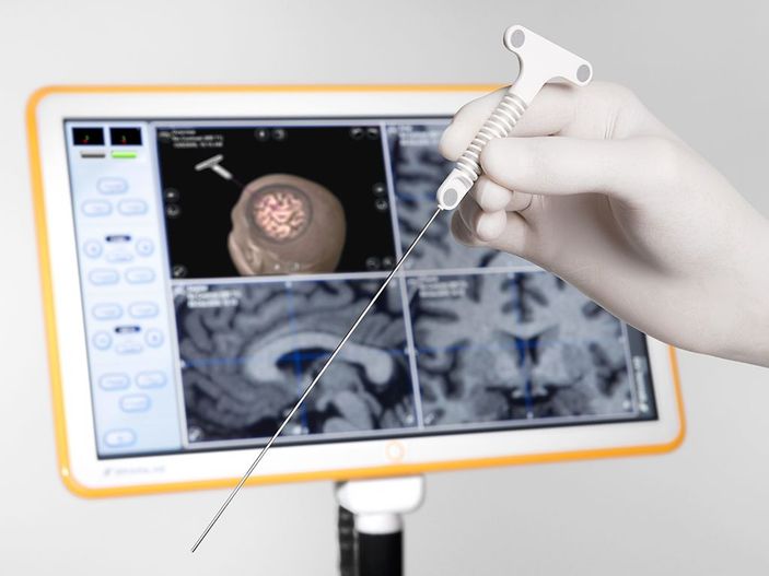 Beyin cerrahisinde nöronavigasyon sistemi