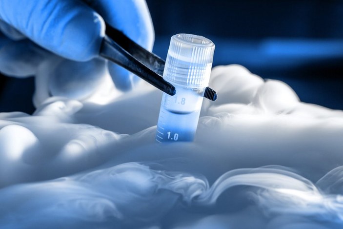 Dondurulmuş embriyo transferinde gebelik şansı artıyor
