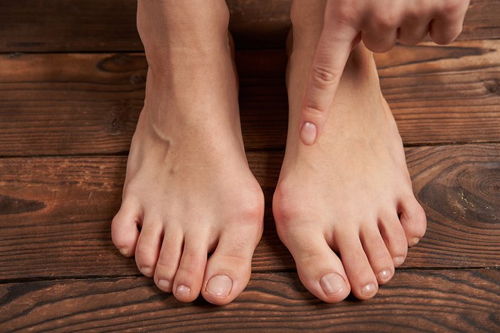 Ayaktaki ağrı birçok rahatsızlığı işaret ediyor olabilir