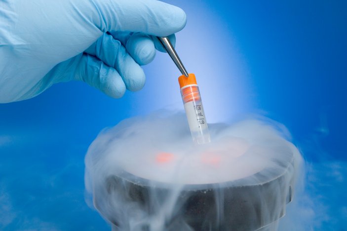 Embriyoyu dondurmak tüp bebek tedavisinde avantaj sağlıyor