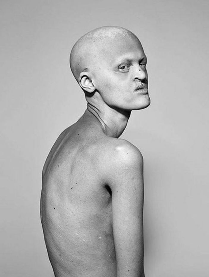 Dünyanın en sıradışı mankeni Melanie Gaydos Magazin haberleri