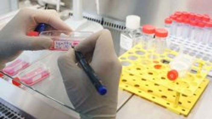 Yaraları Türk icadı iyileştirecek