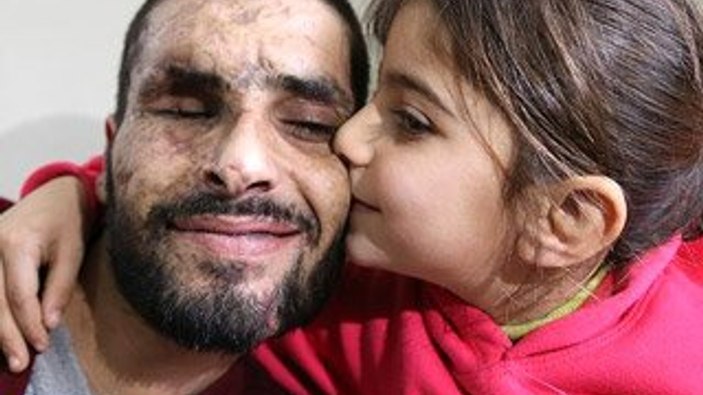 Suriyeli Gözyaşı'nın feryadı babasını hayata döndürdü