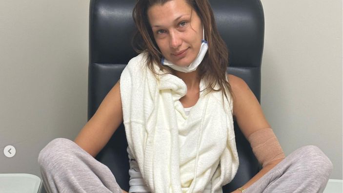 Bella Hadid tedavi sürecini paylaştı