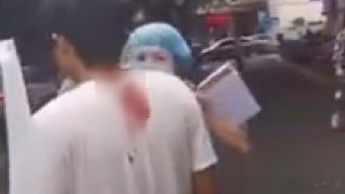 Çin'de kafasına bıçak saplanan adamın sakin tavırları