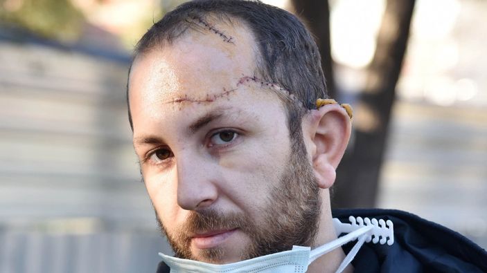 Antalya'da kayınpederi bıçakladı: Eşimi rehin almadım, asıl mağdur benim