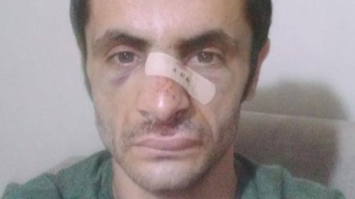 Yalova'da 'maske' uyarısı yapan çalışan darbedildi