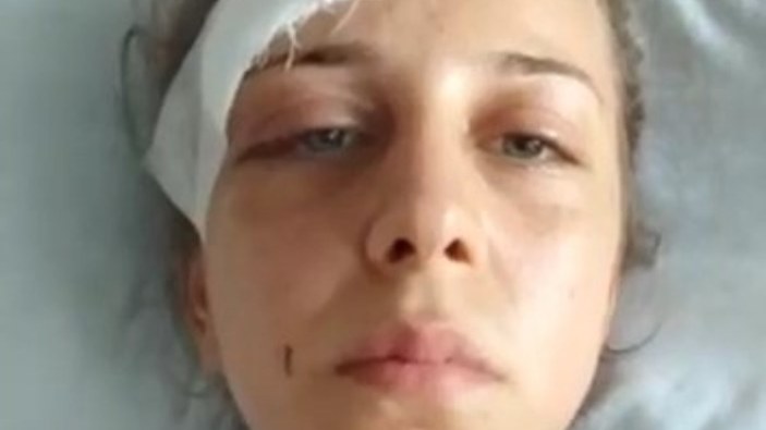 Kocaeli'deki kadın, gördüğü şiddeti çektiği videoyla anlattı