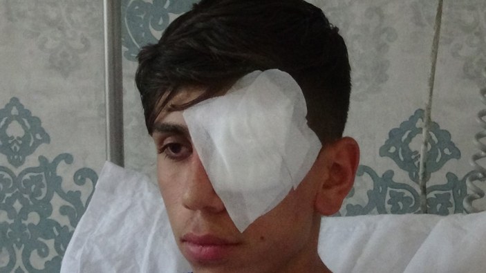 Diyarbakır'da patlatılan maytap, 17 yaşındaki genci gözünden etti