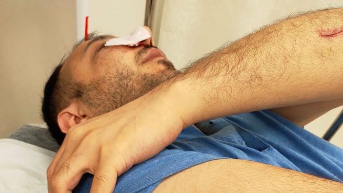 Bağcılar’da, hasta yakını sağlık çalışanına yumruk attı