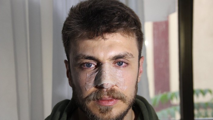 İzmir'de 'Eşimi nasıl muayene edersin' diyerek doktorun burnu kırdı