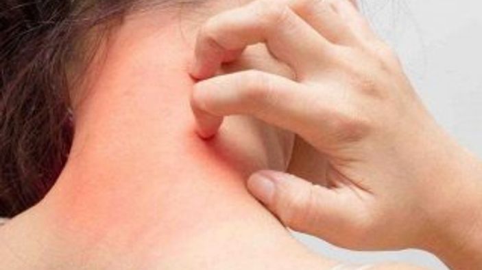 Anaflaksi nedir