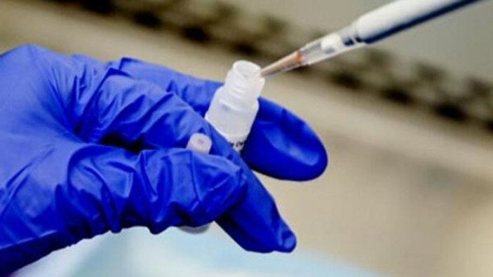 Almanya, korona aşısını insanlarda test edecek