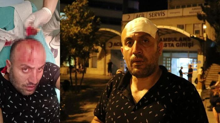 Zonguldak’ta sokak köpeklerini saldırısına uğrayan adam yaralandı