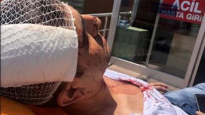 Gazeteci Murat Alan saldırıya uğradı