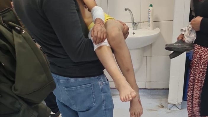Malatya'da sokakta oynayan çocuğa 6 köpek saldırdı