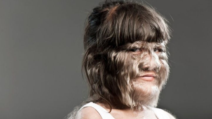 Nadir hastalıklara yüksek teknoloji umudu