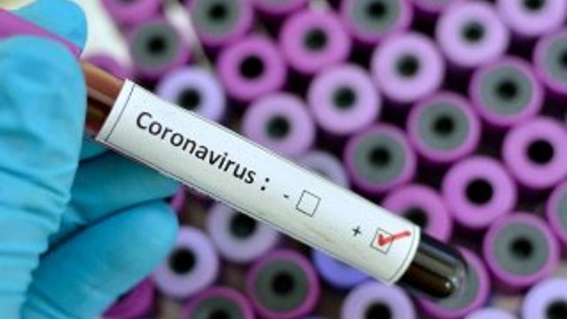 Koronanın tedavisi tüm vatandaşlara ücretsiz yapılacak