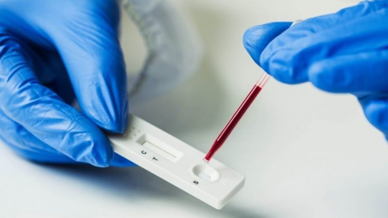 DSÖ, ilk kez bir koronavirüs antikor test kitine uluslararası lisans verdi