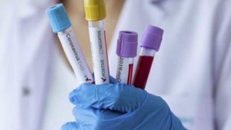 Çekya'da koronavirüs nedeniyle OHAL ilan edildi