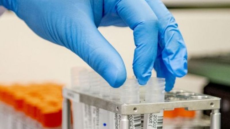 Kan testiyle kansere erken teşhis mümkün